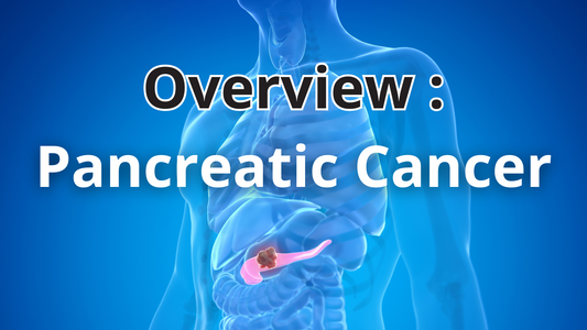 Overview: Pancreatic Cancer