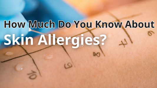 How Much Do You Know About Skin Allergies?