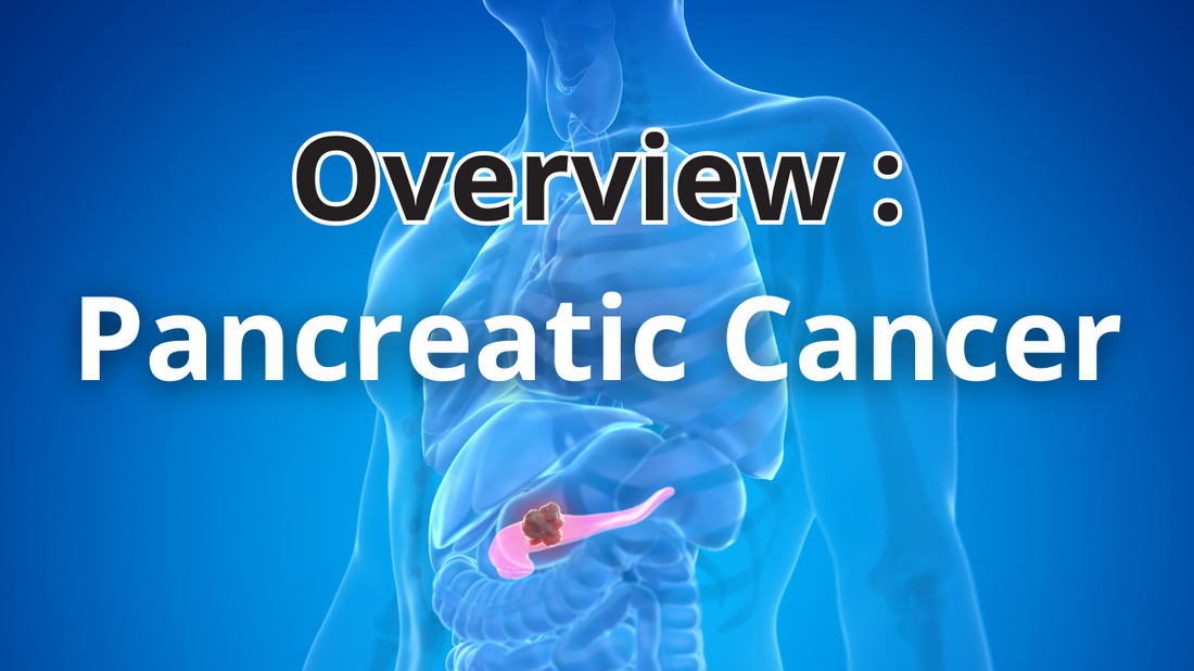 Overview: Pancreatic Cancer