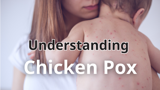 Understanding Chicken Pox